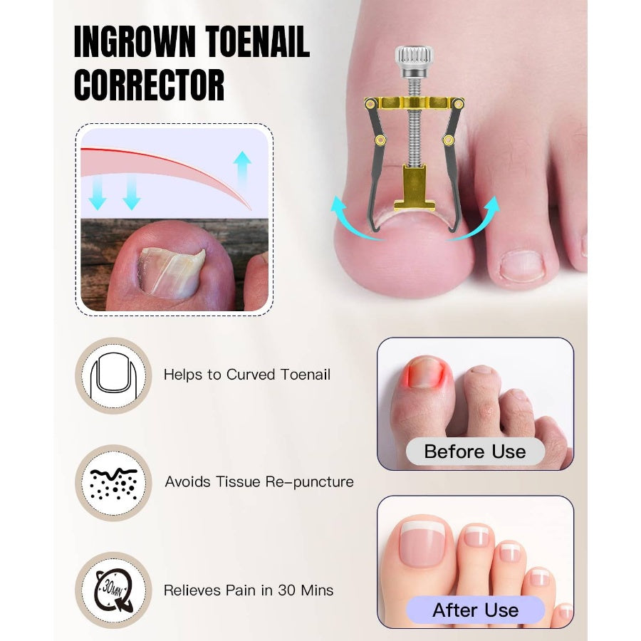 12Pcs Ingrown Toenail Removal Kit - Toenail Clippers Ingrown Thick Hard Nails - Ingrown Toenail with Toe Nail ClippersNail CutterPedicure KnifeCallus Remover Tools Seniors Men Women